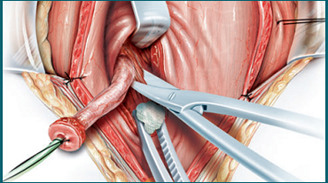 Cosmetic Treatment Ahmedabad,Liposuction Surgeons In Ahmedabad